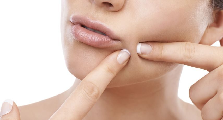acne-treatment-galway